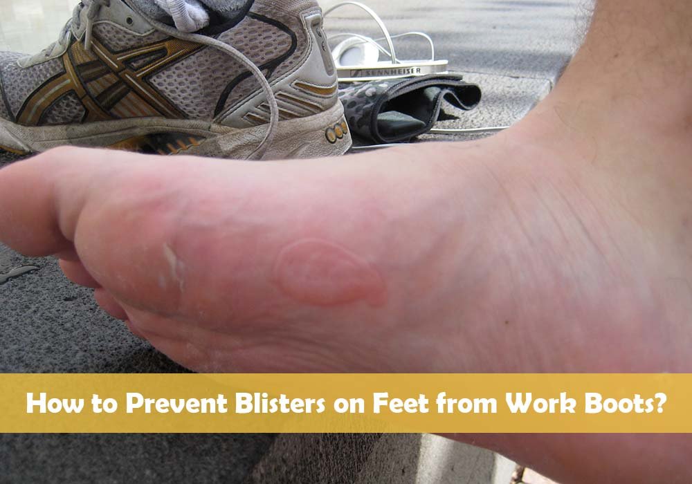 How to Prevent Blisters on Feet from Work Boots