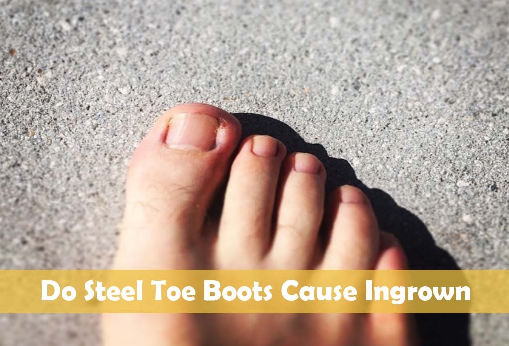 Do Steel Toe Boots Cause Ingrown Toenails